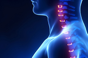 Orthokinética