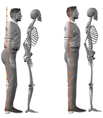 Orthokinética