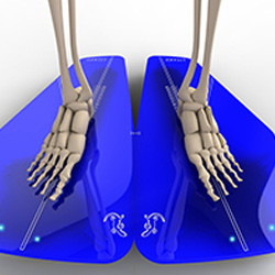 Orthokinética
