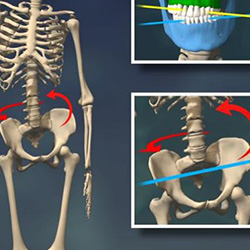 Orthokinética