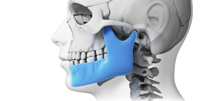 Orthokinética